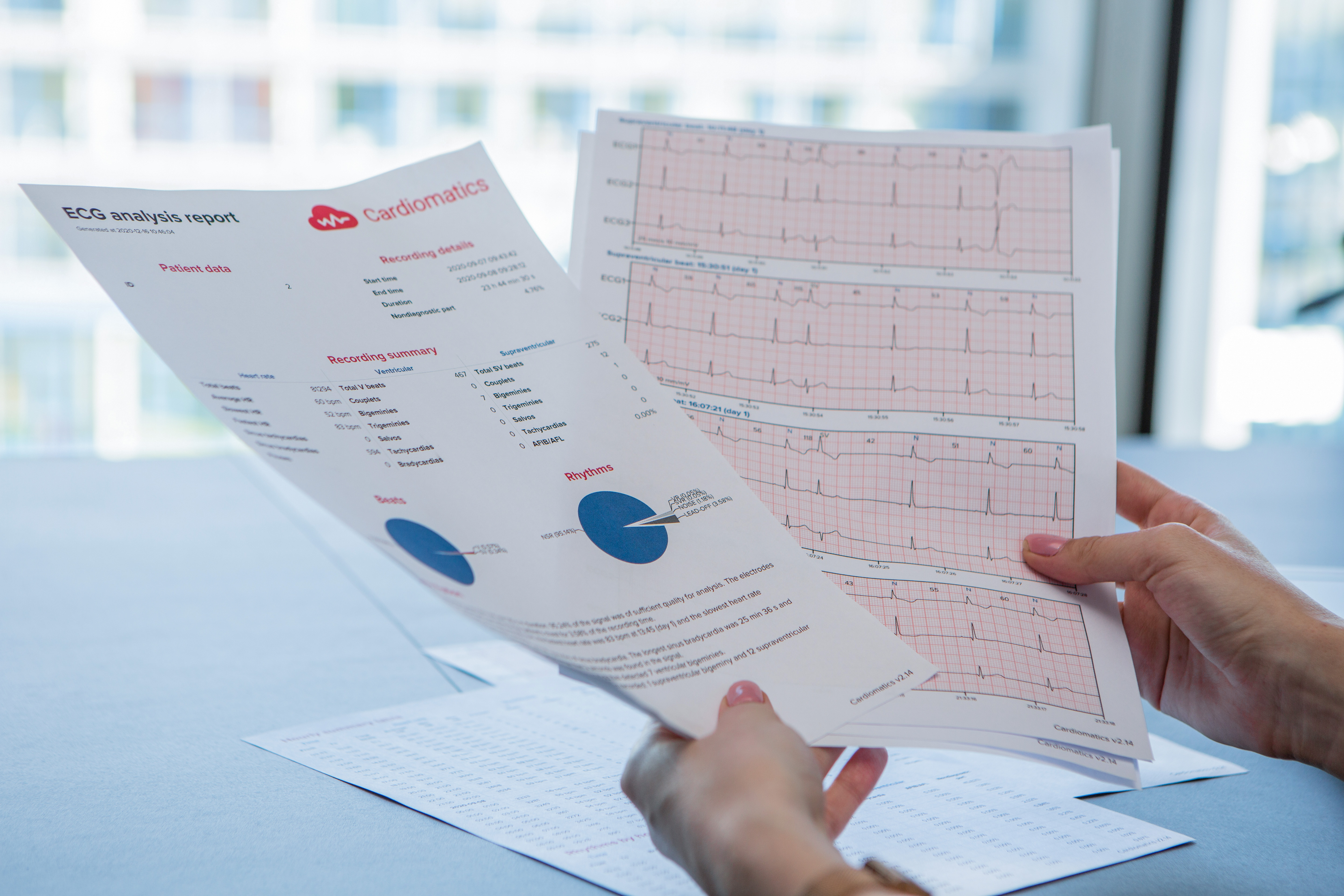 Przegląd startupów #1 - Cardiomatics